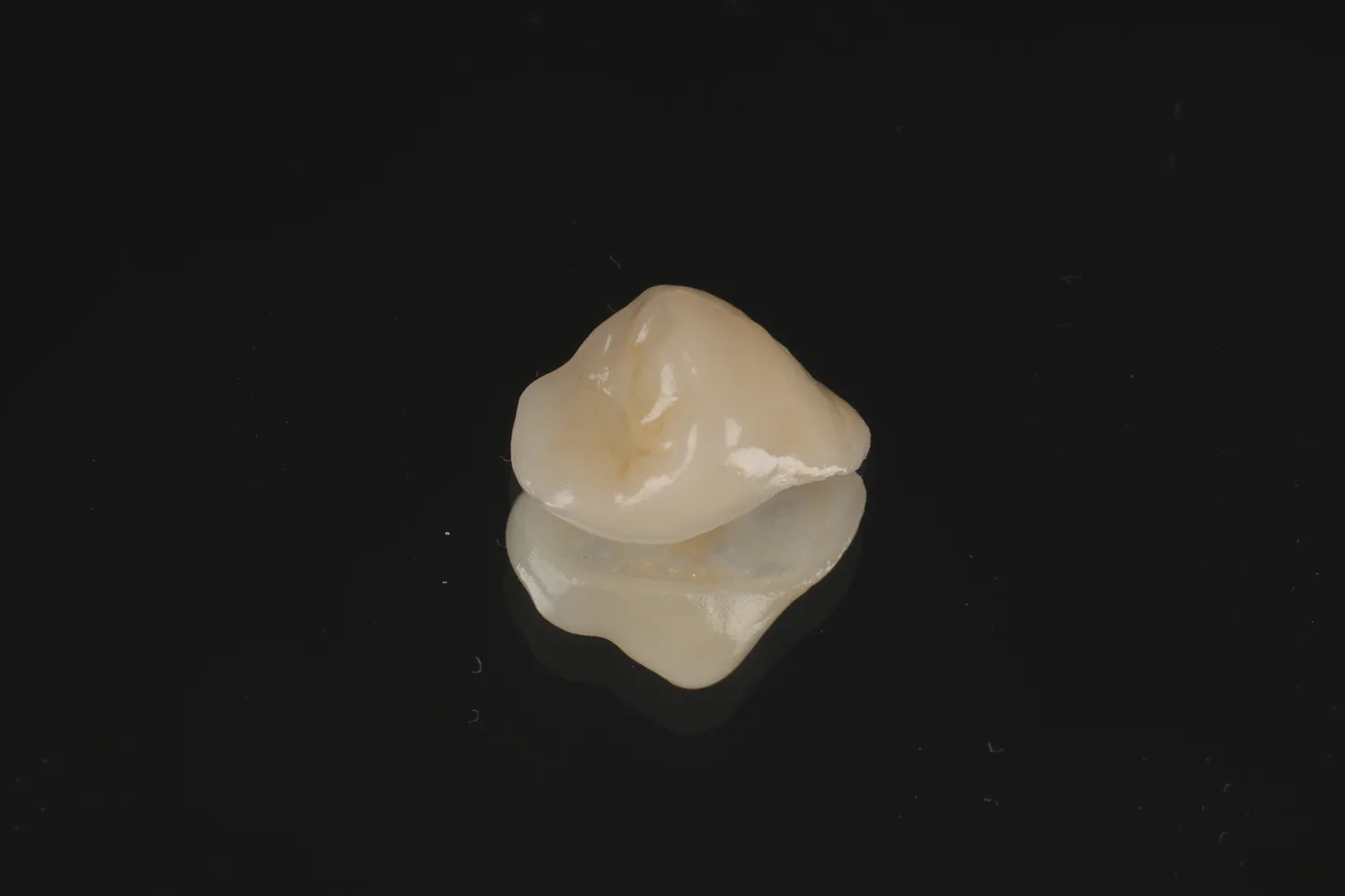Een keramische onlay (e.max) uit ons eigen lab, close-up tegen een donkere achtergrond